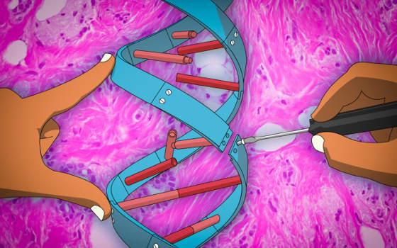 A new gene therapy technique being developed by researchers at MIT uses microRNAs - small noncoding RNA molecules that regulate gene expression - to control breast cancer metastasis. Image: MIT News